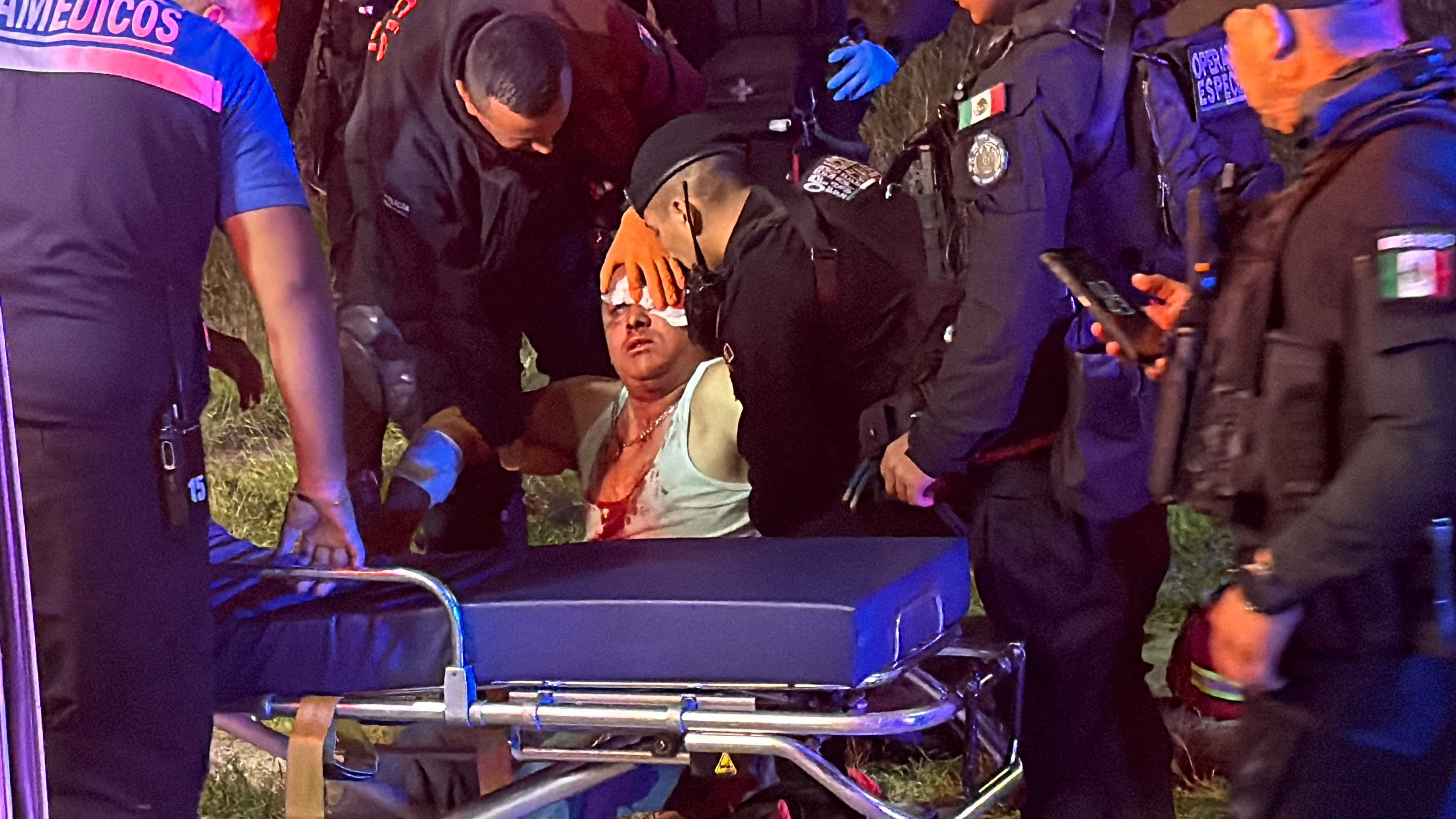 Dos hermanos resultan heridos con machete tras riña en el fraccionamiento Municipio Libre - imagen de origen